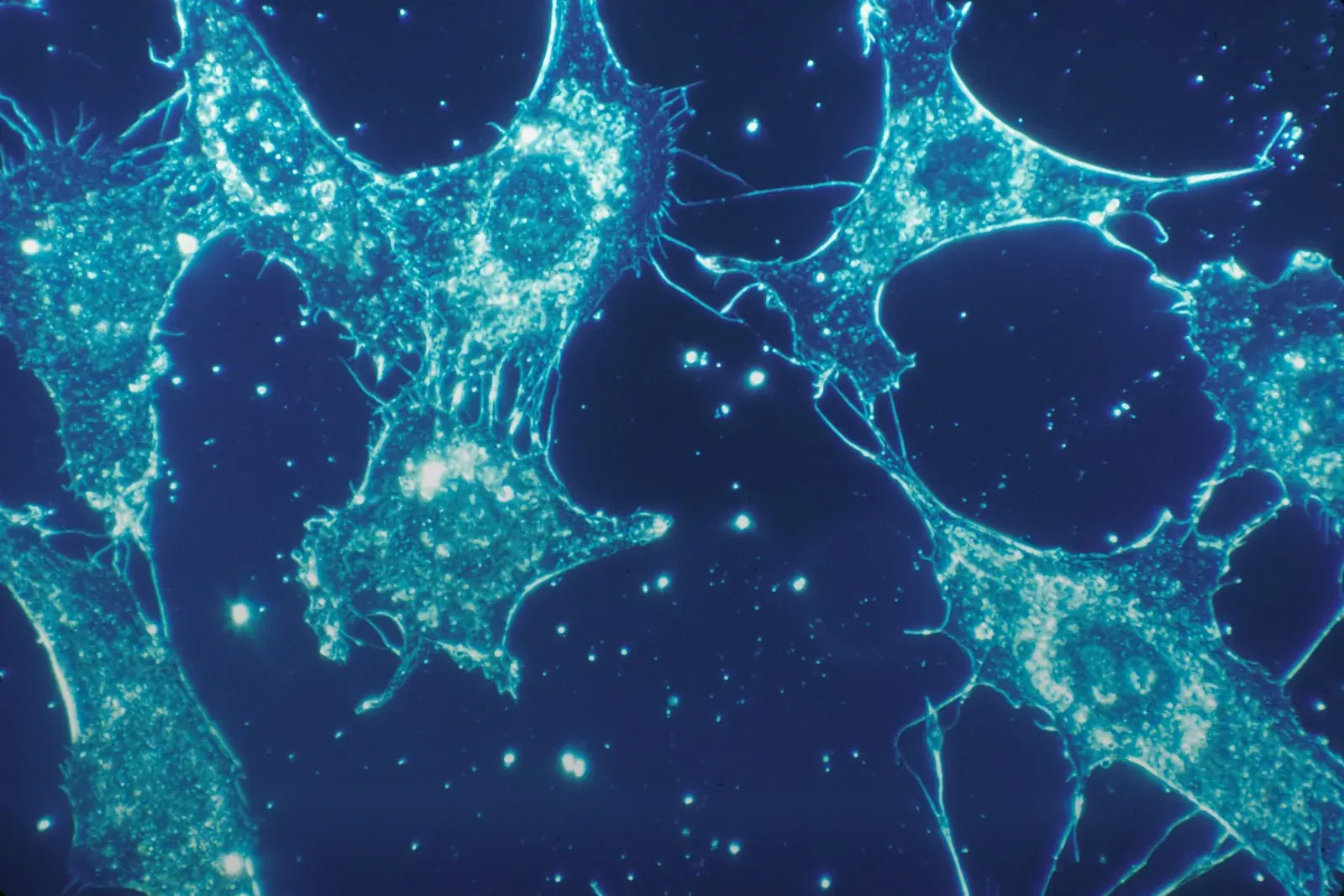 Fluorescence microscope in a research laboratory imaging fluorescently labelled cells
